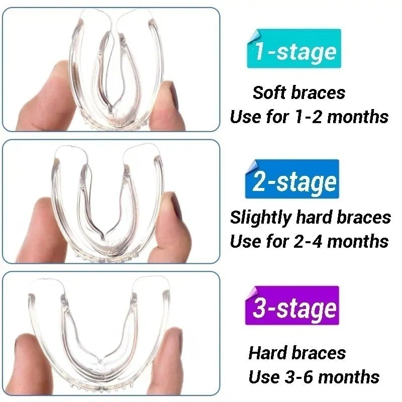 Braces Alignment Trainer Teeth