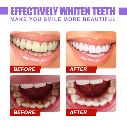 V34 Teeth Whitening Toothpaste